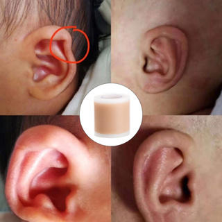 Vendaje corrector de oído Baby Auricle, corrección de orejas Parche valgo oreja  bebé estético para salientes Correctores silicona para recién nacidos  Parches sobresalientes Pegatinas : : Bebé