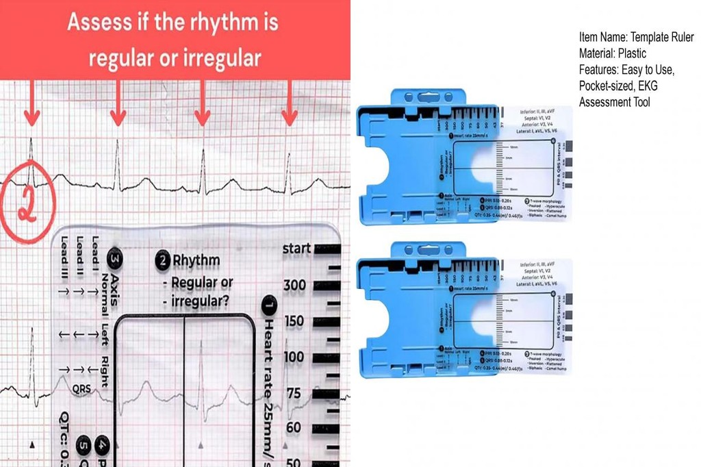 Electrocardiogram Measurement Tool 7-step Ekg Assessment Method Card ...